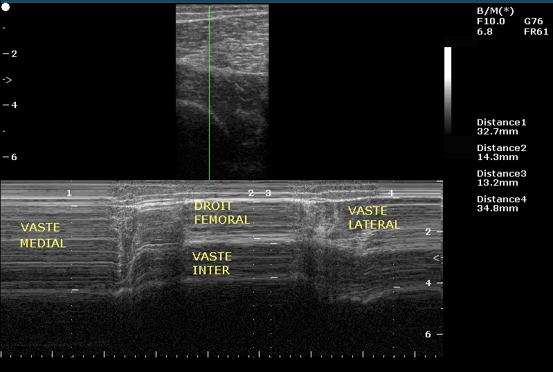 Fig 10